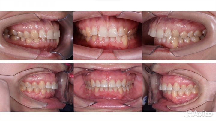 Врач-стоматолог ортодонт