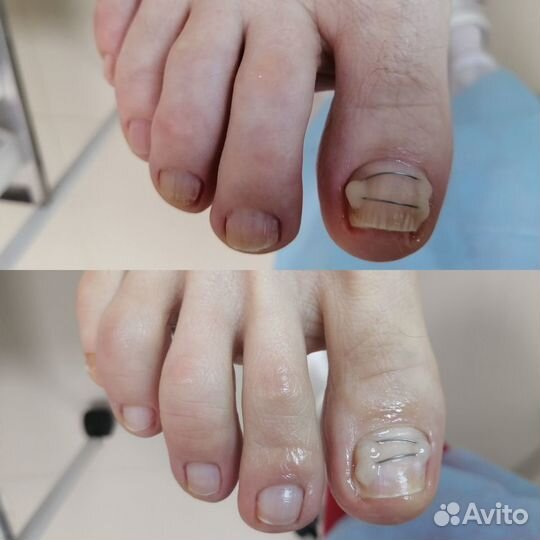 Услуги подолога