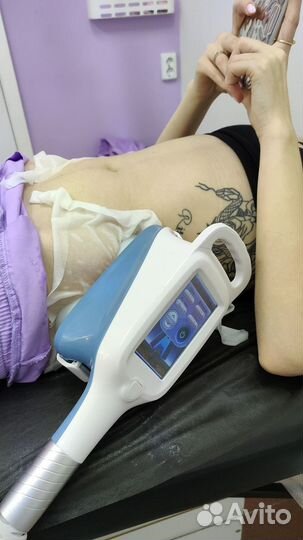 Криолиполиз