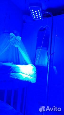 Фотолампа для лечения желтушки