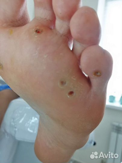 Услуги подолога