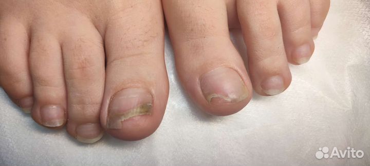 Аппаратный маникюр