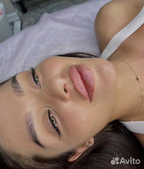 Увеличение губ Контурная пластика Липолитики