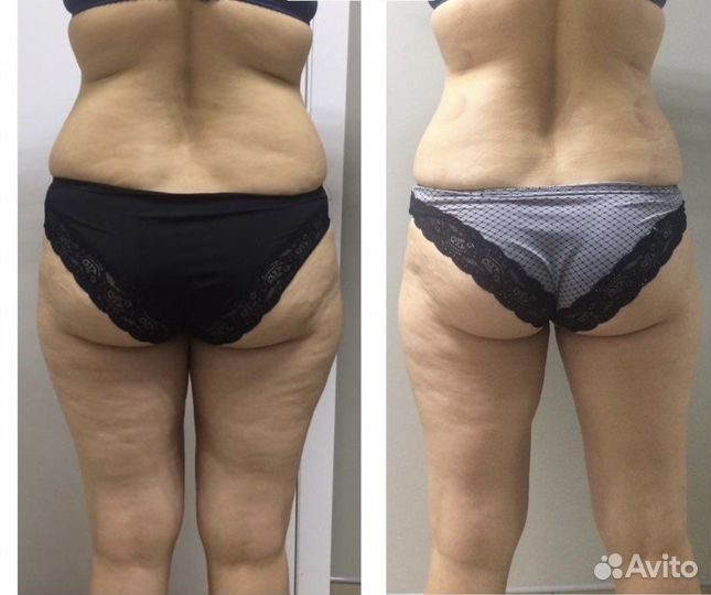 Похудей за 5 дней