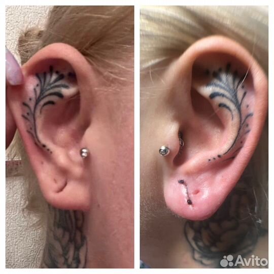 Пирсинг и микродермалы (медицинское образование)