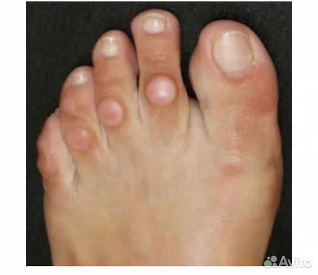 Выезд на дом.Педикюр пожылым.Медицинский педикюр