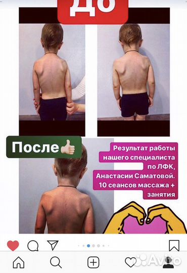 Детский массаж\лфк\консультация