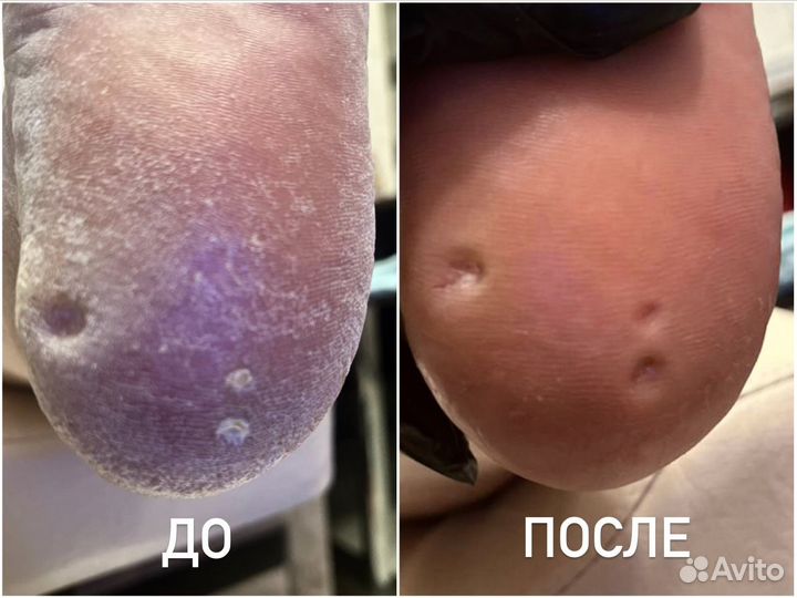 Подолог с выездом на дом