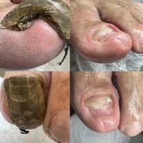 Семейный подолог. Избавлю от боли и стресса), Москва