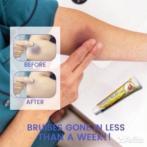 Мазь от синяков