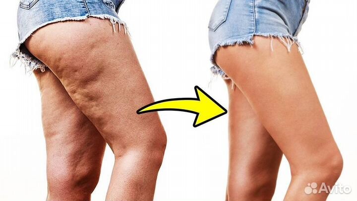 Антицеллюлитный крем