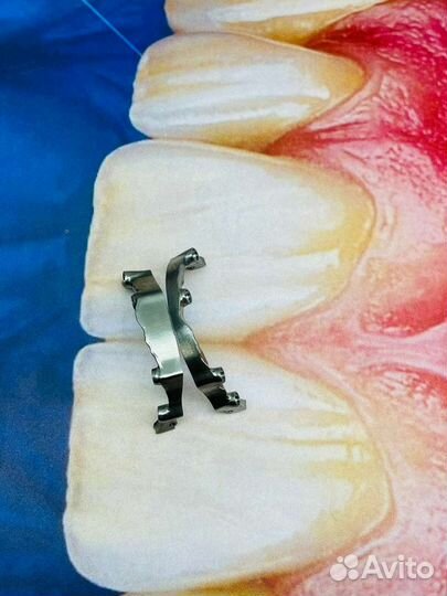 Зубной техник