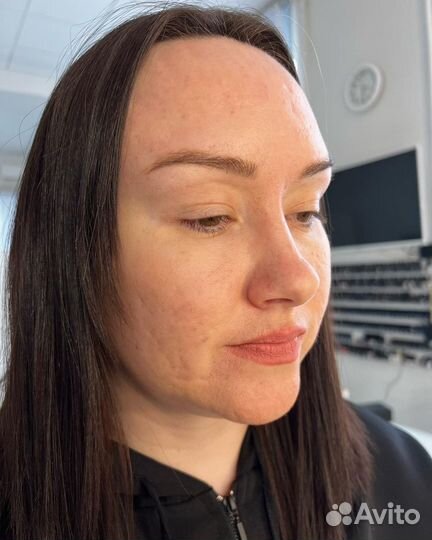 Брови Одинцово