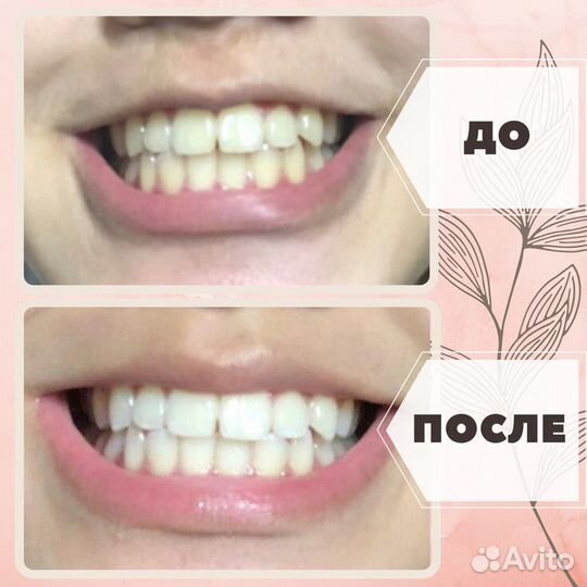 Полоски для отбеливания зубов Crest 3D Professiona