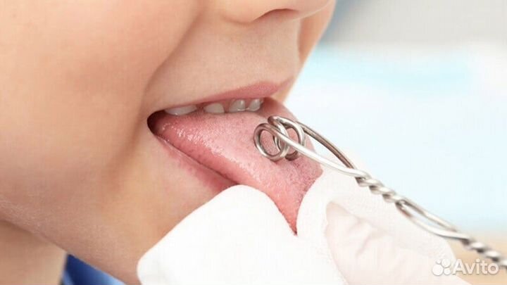 Логопедический массаж