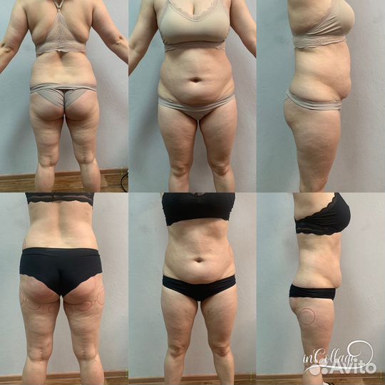 Похудей за 5 дней