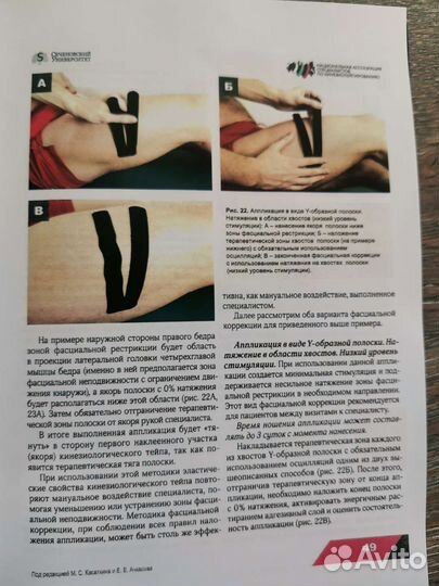 Руководство по кинезиологическому тейпированию