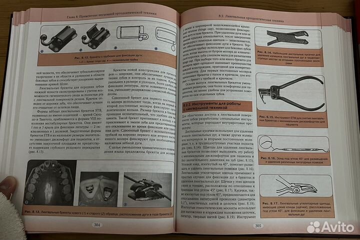 Книги по ортодонтии