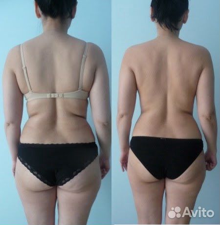 Лечебный массаж