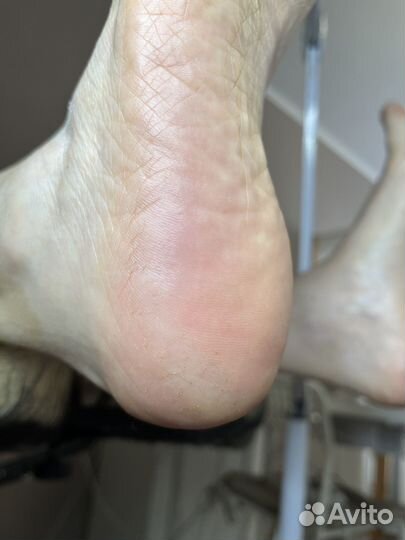 Педикюр, подолог