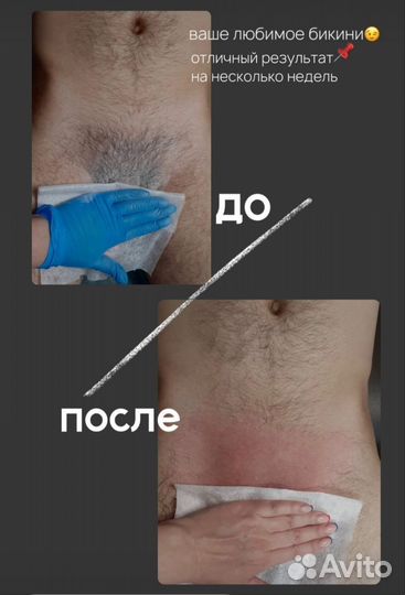 Шугаринг, восковая депиляция