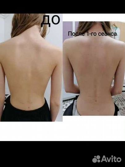 Лечебный массаж