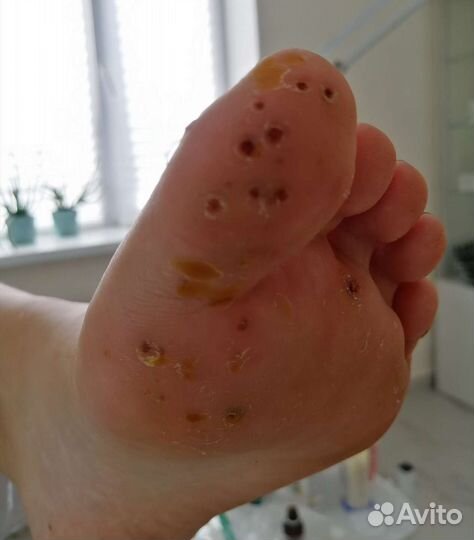 Услуги подолога