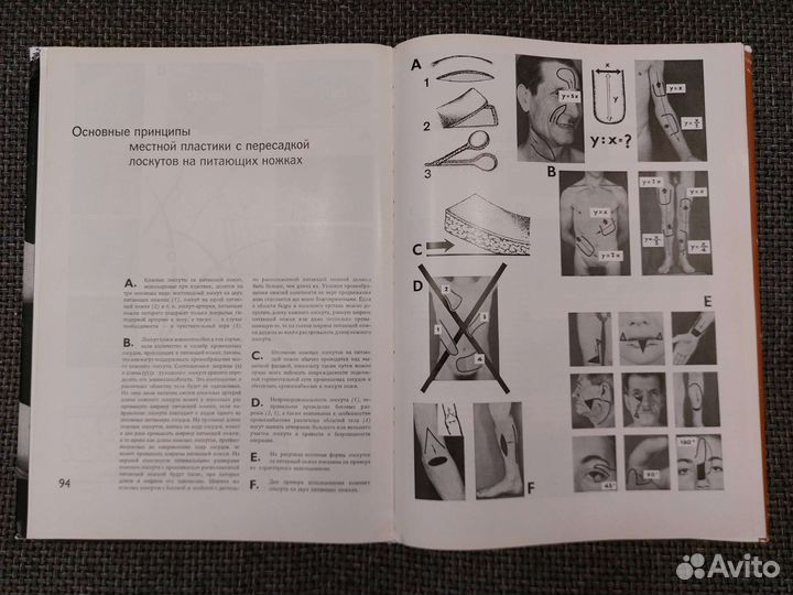 Я. Золтан - Cicatrix Optima. Операционная техника