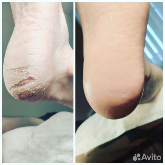 Мужской и женский педикюр smart