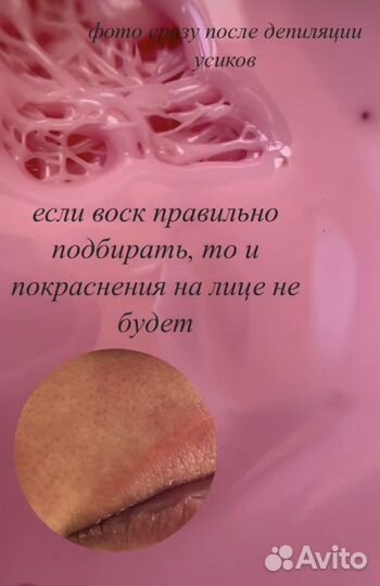 Восковая депиляция