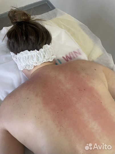 Антицеллюлитный массаж