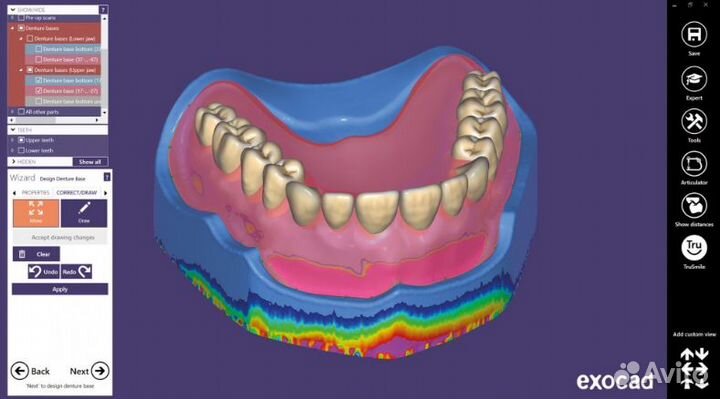 Exocad 8349 (3.1) последняя версия
