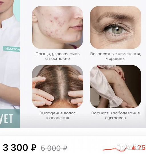 Аппарат дарсонваль