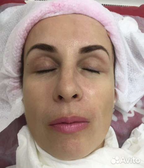 Скульптурный массаж лица