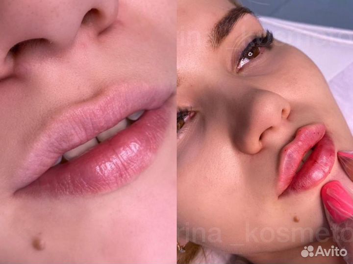 Услуги косметолога