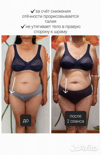 Остеопластический массаж спины и живота