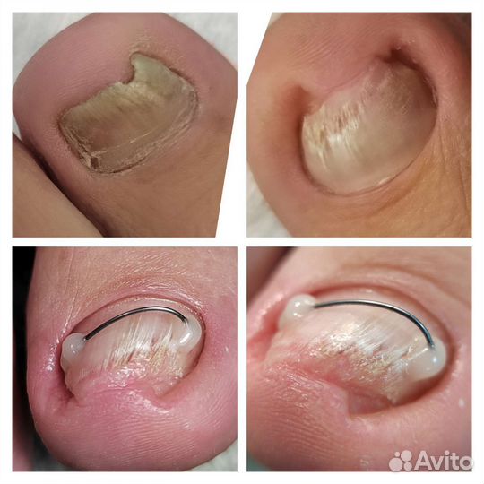 Подолог сормово