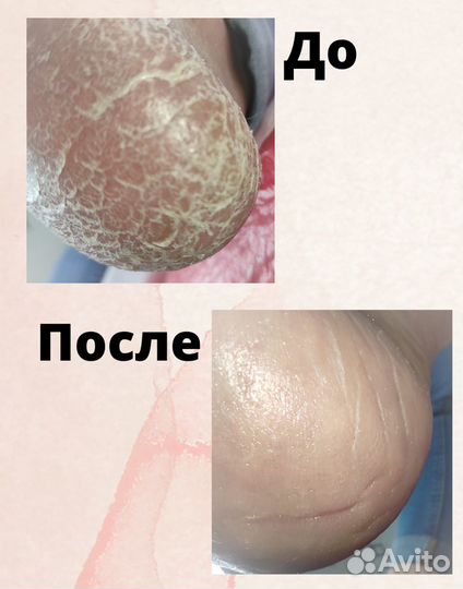Педикюр, подолог (проблема стопы и ногтей)