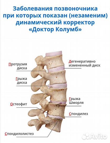 Корректор для позвоночника