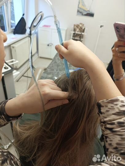 Выпадение волос, алопеция,жирность кожи головы