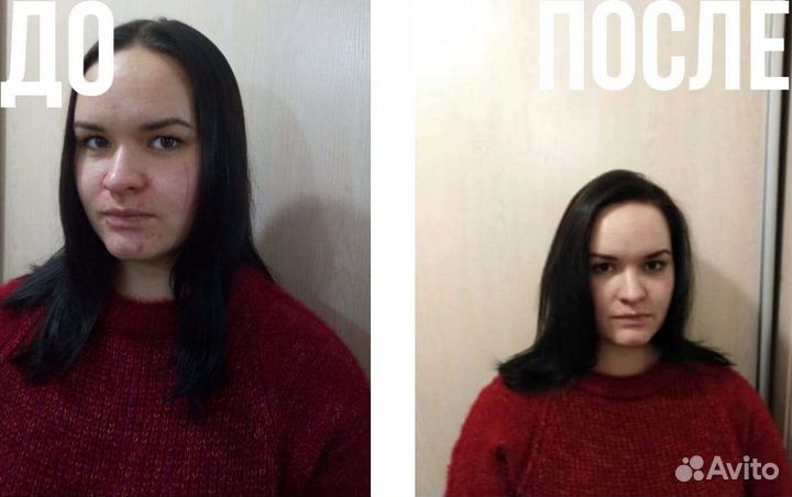 Флисинг - прикорневой обьем