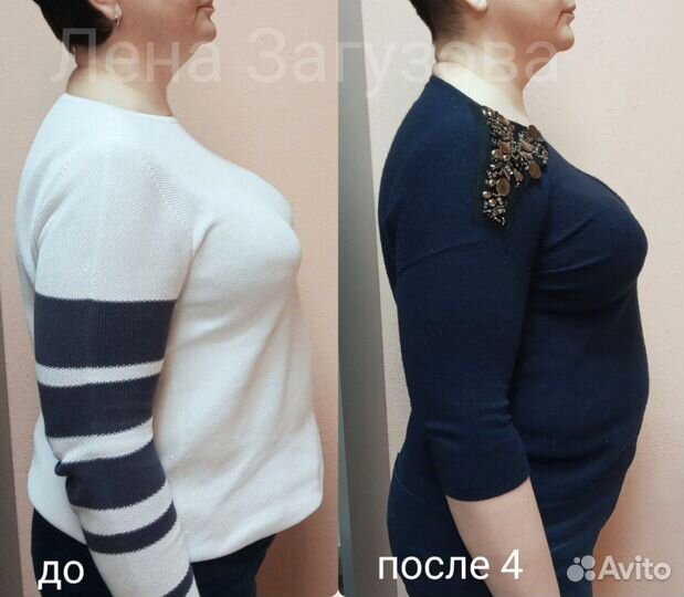 Эстетическая коррекция тела. Не массаж