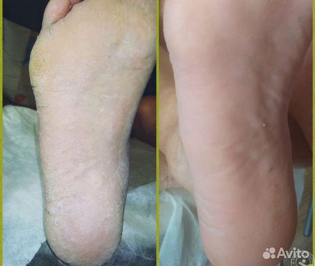 Маникюр и педикюр, гель лак