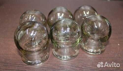 Банки медицинские стеклянные на спину, СССР