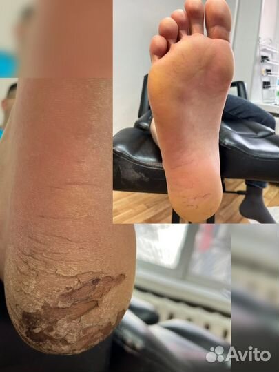 Подология/ Педикюр