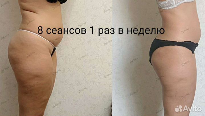 Массаж для похудения