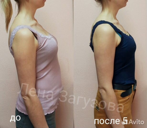 Эстетическая коррекция тела. Не массаж