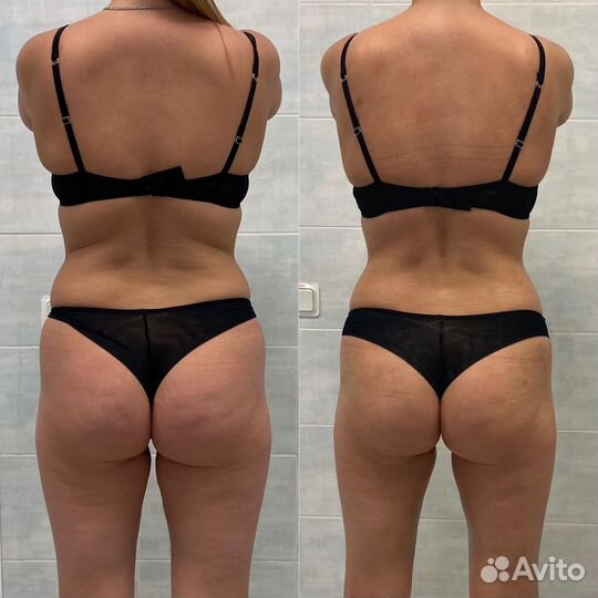 Ищем модель на коррекцию фигры