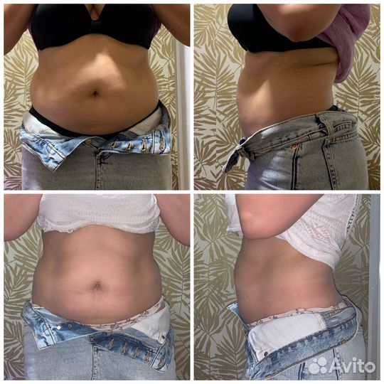 Аппаратная коррекция фигуры