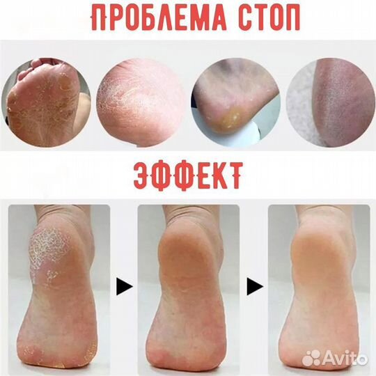 Смарт педикюр